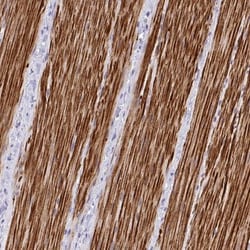 ZSWIM9 Antibody, Novus Biologicals:Antibodies:Primary Antibodies